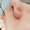 Benefits Of Teeth Polishing