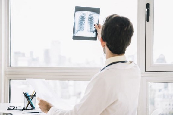 doctor-read-lung-rentgen-results